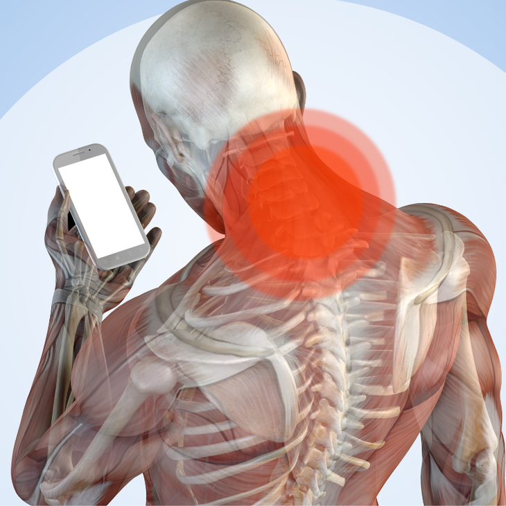 Giải pháp hỗ trợ phòng ngừa hội chứng 'Tech Neck'- Ảnh 1.