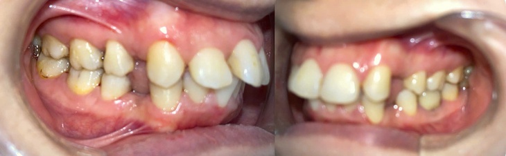 Đi tái khám, nữ sinh sững sờ khi thấy phòng khám niềng răng đã 'biến mất'- Ảnh 1.