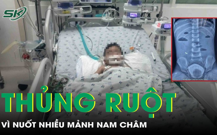 Người đàn ông nhập viện vì nuốt nhầm viên thuốc còn nguyên vỏ- Ảnh 2.