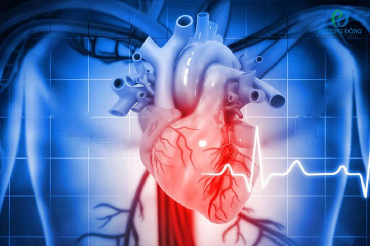 Suy tim cấp: Những điều cần biết về hiểm hoạ và cách điều trị