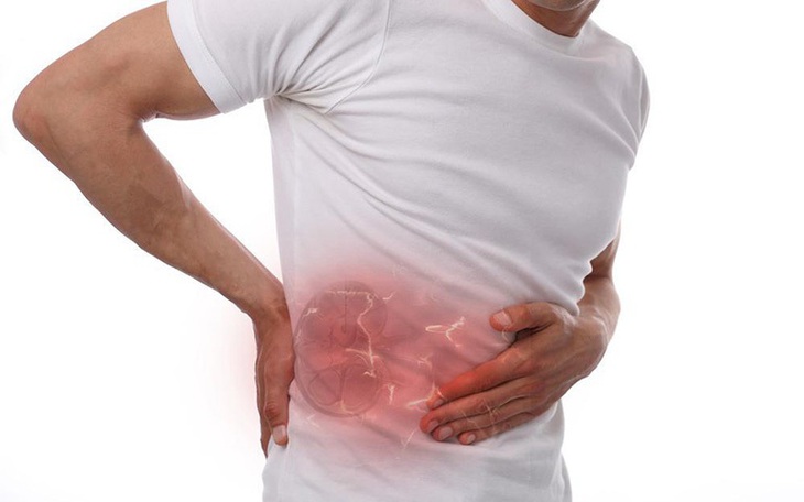 Đau lưng kéo dài, người đàn ông 60 tuổi phát hiện ung thư thận hiếm gặp- Ảnh 1.