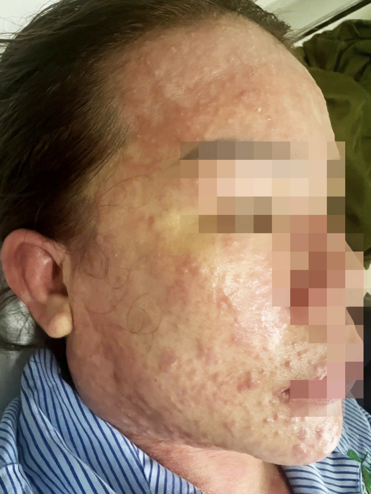 Một phụ nữ nguy kịch sau khi dùng thuốc giảm cân thải độc, collagen không rõ nguồn gốc- Ảnh 3.