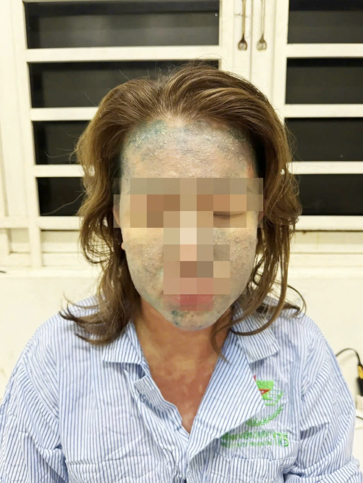Một phụ nữ nguy kịch sau khi dùng thuốc giảm cân thải độc, collagen không rõ nguồn gốc- Ảnh 1.