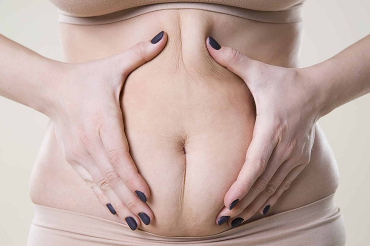 Vì sao ăn ít vẫn có mỡ bụng?- Ảnh 1.