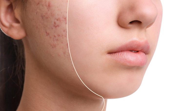 7 vấn đề về da mùa hè có thể ngăn ngừa- Ảnh 1.