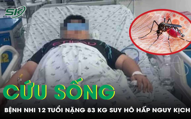 Cứu sống bệnh nhi 12 tuổi béo phì sốc sốt xuất huyết, biến chứng suy hô hấp nặng 