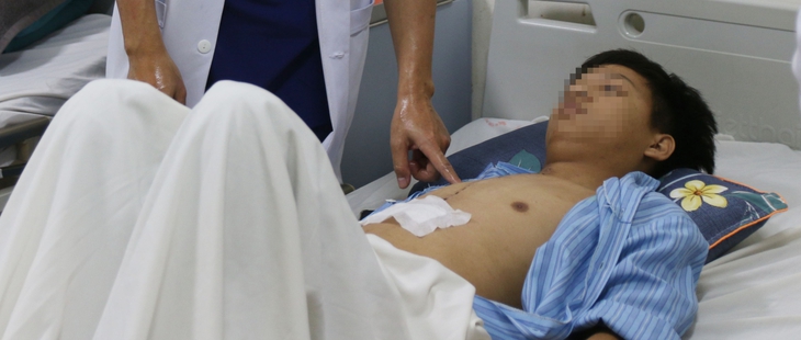 Những biến chứng sau phẫu thuật tim cần lưu ý- Ảnh 3. Những biến chứng sau phẫu thuật tim cần lưu ý- Ảnh 3.