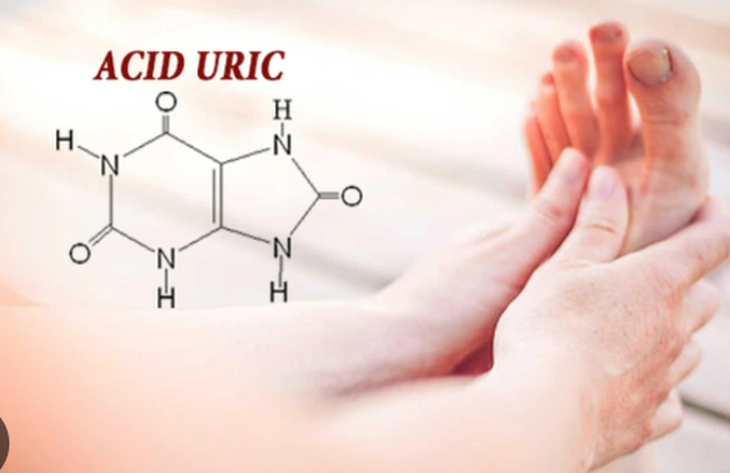 Acid uric cao gây hại như thế nào?- Ảnh 1.