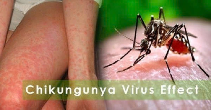 Chikungunya dễ gây tàn phế và nhầm lẫn với sốt xuất huyết- Ảnh 2. Chikungunya dễ gây tàn phế và nhầm lẫn với sốt xuất huyết- Ảnh 2.