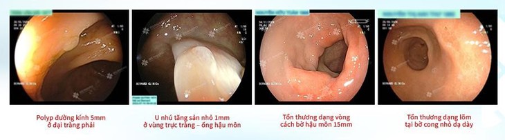 Bernard ứng dụng công nghệ và quy trình kiểm soát 3 lớp chất lượng nội soi chuẩn Nhật- Ảnh 1. Bernard ứng dụng công nghệ và quy trình kiểm soát 3 lớp chất lượng nội soi chuẩn Nhật- Ảnh 1.