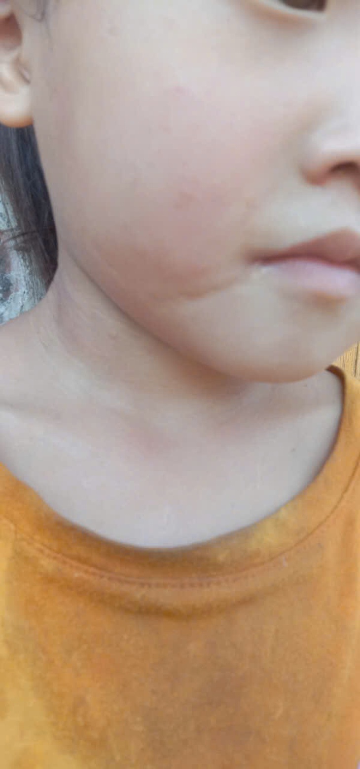 Những nỗ lực chăm sóc bà mẹ, trẻ em ở Lũng Cú và câu chuyện lay động cứu sống bé sơ sinh bị rạch một vết sâu vào má- Ảnh 4.