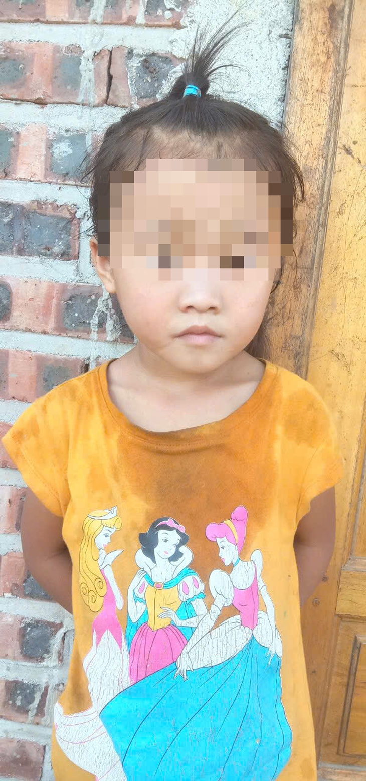 Những nỗ lực chăm sóc bà mẹ, trẻ em ở Lũng Cú và câu chuyện lay động cứu sống bé sơ sinh bị rạch một vết sâu vào má- Ảnh 3.