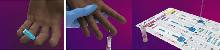 WHO phê duyệt bộ xét nghiệm nhanh phát hiện đồng thời HIV, viêm gan B và giang mai- Ảnh 1. WHO phê duyệt bộ xét nghiệm nhanh phát hiện đồng thời HIV, viêm gan B và giang mai- Ảnh 1.
