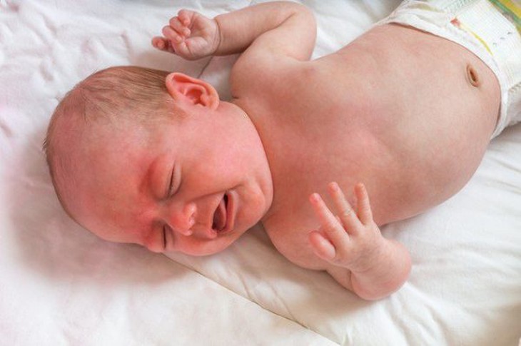 Nhận biết những dấu hiệu bất thường ở trẻ sơ sinh- Ảnh 2.