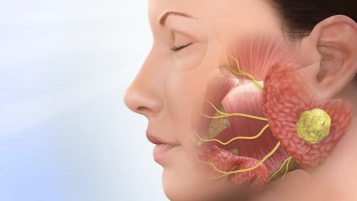 Đau đột ngột như dao đâm vùng hàm mặt cảnh giác với đau dây thần kinh số 5 - Ảnh 1.