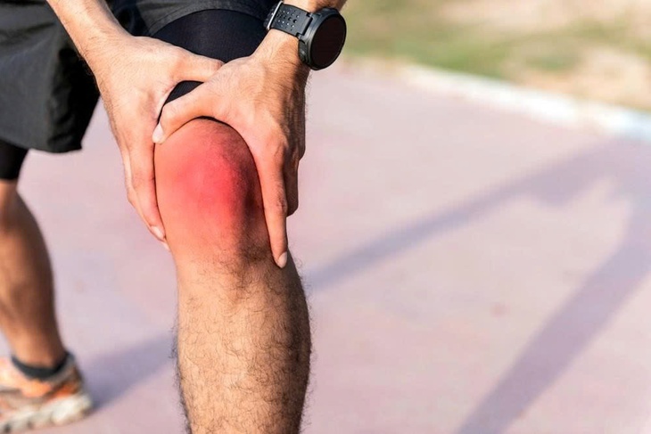 Đau nhức sau khi tập luyện thể thao, có nên dán miếng giảm đau?- Ảnh 1.