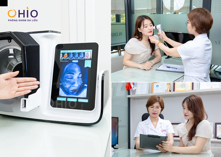 Trị giãn mao mạch ở đâu an toàn?- Ảnh 1.