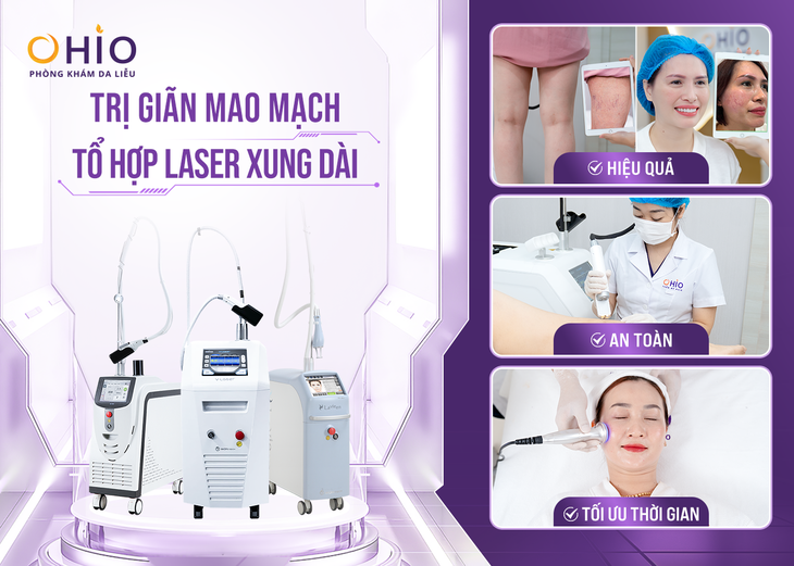 Trị giãn mao mạch ở đâu an toàn?- Ảnh 2.