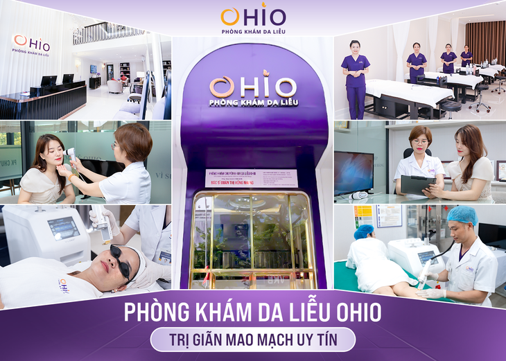 Trị giãn mao mạch ở đâu an toàn?- Ảnh 3.