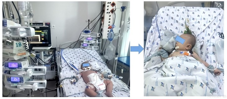 Sốt xuất huyết ở TPHCM tăng mạnh, nhiều trẻ nguy kịch do biến chứng nặng- Ảnh 1. Sốt xuất huyết ở TPHCM tăng mạnh, nhiều trẻ nguy kịch do biến chứng nặng- Ảnh 1.