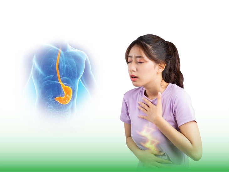 Hỗ trợ giảm nhanh rối loạn tiêu hóa và dư axit dạ dày: Giải pháp từ Châu Âu- Ảnh 1.