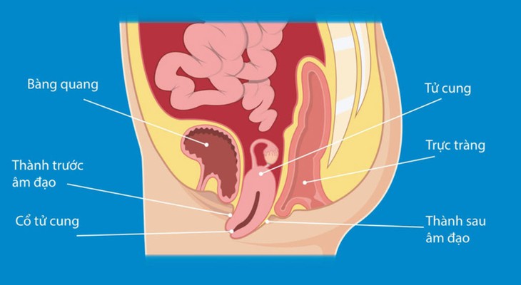 Vì sao phụ nữ sau sinh dễ bị sa cơ quan vùng chậu?- Ảnh 2.