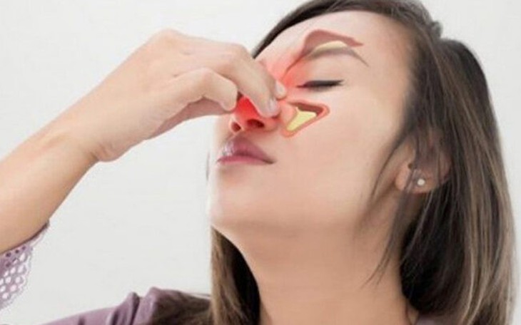 Viêm xoang mũi dị ứng chữa thế nào?