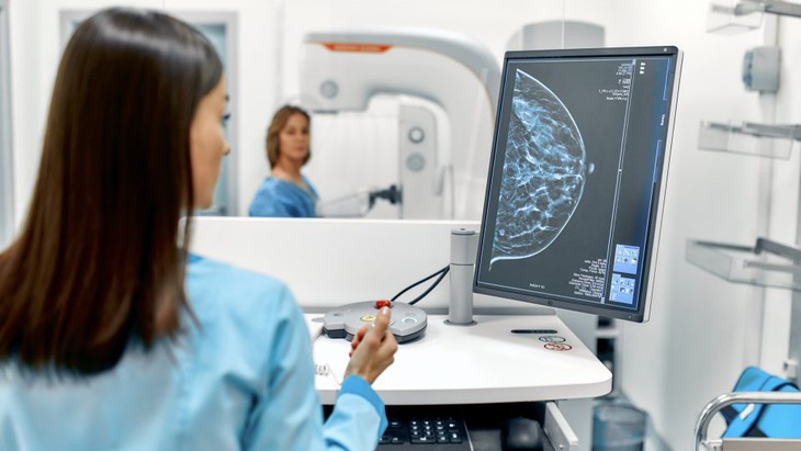 Trí tuệ nhân tạo (AI) giúp phát hiện chính xác ung thư vú- Ảnh 3.