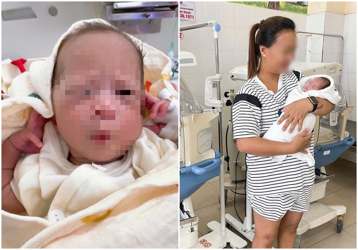 Giành giật sự sống cho bé gái sinh non bị suy hô hấp từ người mẹ mắc hội chứng HELLP- Ảnh 1.