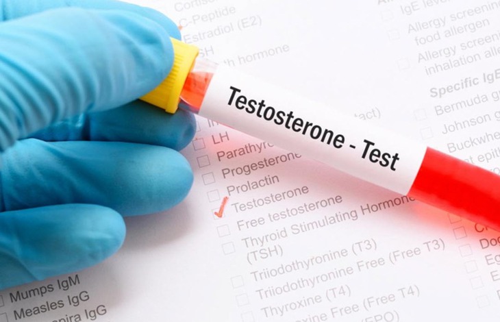 Nguyên nhân nam giới trẻ bị testosterone thấp- Ảnh 2.