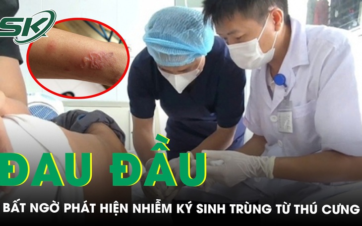 Phẫu thuật khối u, phát hiện ký sinh trùng dạng sán trong vùng hố chậu bệnh nhân- Ảnh 2.