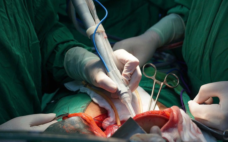 Người đàn ông mắc ung thư gan hồi sinh nhờ công nghệ hiện đại lần đầu đầu thực hiện ở Đồng bằng sông Cửu Long