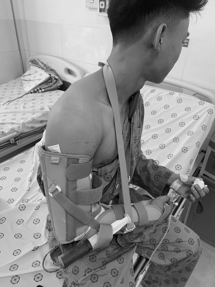 Chơi vật tay, nam thanh niên 18 tuổi bị gãy xương cánh tay- Ảnh 3. Chơi vật tay, nam thanh niên 18 tuổi bị gãy xương cánh tay- Ảnh 3.
