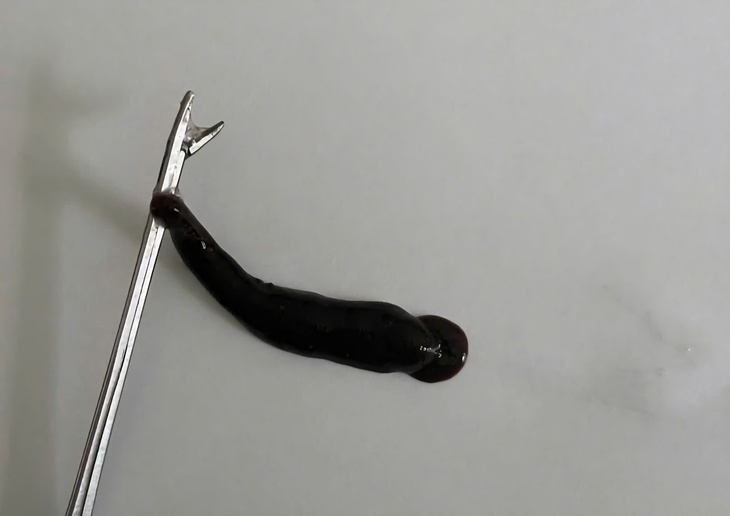 Đỉa dài 4cm ký sinh trong mũi bé trai suốt 10 ngày- Ảnh 1. Đỉa dài 4cm ký sinh trong mũi bé trai suốt 10 ngày- Ảnh 1.