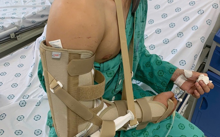 Chơi vật tay, nam thanh niên 18 tuổi bị gãy xương cánh tay