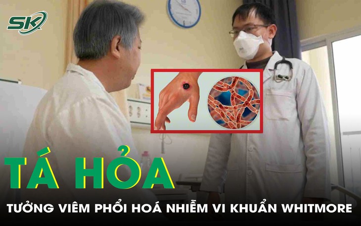 Cứu sống trẻ mắc bệnh Whitmore nguy hiểm- Ảnh 2.