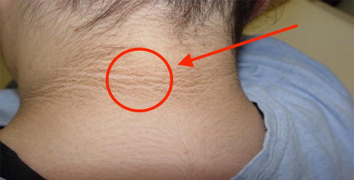 Tiền tiểu đường là gì? Cách phòng ngừa tiến triển thành bệnh tiểu đường- Ảnh 1. Tiền tiểu đường là gì? Cách phòng ngừa tiến triển thành bệnh tiểu đường- Ảnh 1.