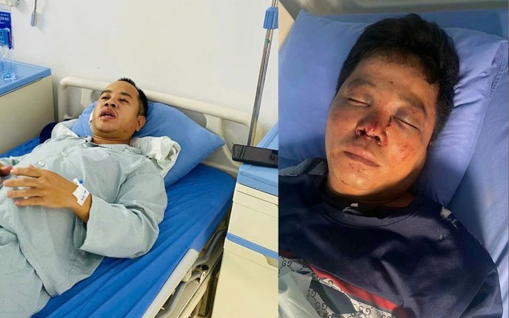 Hi hữu: Bé trai 7 tuổi tử vong khi vặn ga xe máy gây tai nạn- Ảnh 2.