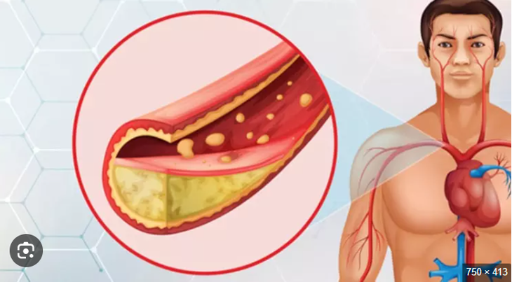 6 loại đồ uống khi bụng đói giúp giảm cholesterol xấu - Ảnh 1.