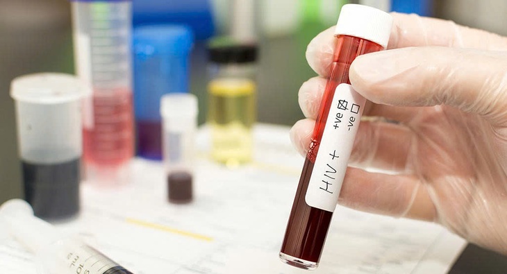 Phát hiện HIV ở thai phụ khi chuyển dạ: Thách thức và nguy cơ tiềm ẩn- Ảnh 1.