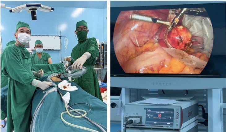 Ê-kíp bác sĩ TPHCM phẫu thuật thành công bướu quái buồng trứng cho bệnh nhân tại Côn Đảo- Ảnh 1. Ê-kíp bác sĩ TPHCM phẫu thuật thành công bướu quái buồng trứng cho bệnh nhân tại Côn Đảo- Ảnh 1.