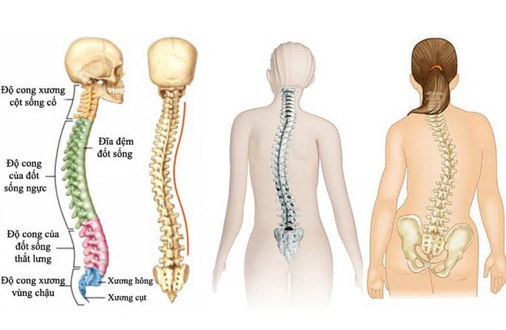 Vì sao cong vẹo cột sống thường gặp ở tuổi dậy thì?- Ảnh 1.