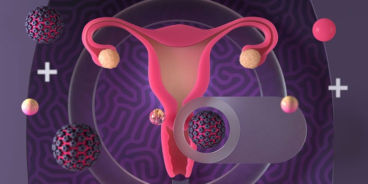 Các yếu tố làm tăng nguy cơ nhiễm HPV gây ung thư cổ tử cung- Ảnh 1. Các yếu tố làm tăng nguy cơ nhiễm HPV gây ung thư cổ tử cung- Ảnh 1.