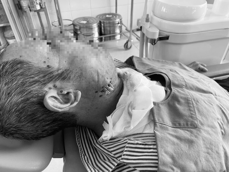 Suýt mất mạng vì tự ý đi đốt nhiệt khi đau răng- Ảnh 1. Suýt mất mạng vì tự ý đi đốt nhiệt khi đau răng- Ảnh 1.