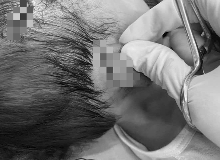 Bé gái 19 tháng tuổi bị chó dữ tấn công- Ảnh 1. Bé gái 19 tháng tuổi bị chó dữ tấn công- Ảnh 1.