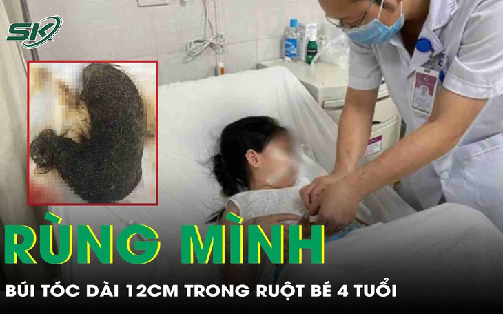  Búi tóc lớn nằm trong dạ dày cháu bé 4 tuổi- Ảnh 3.