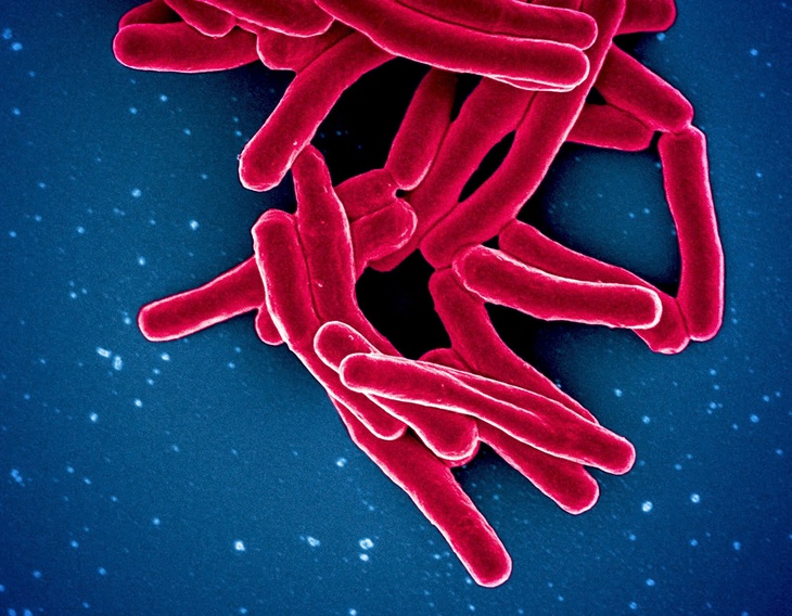 Người nhiễm HIV cần làm gì để phòng tránh lao tái phát?- Ảnh 1.