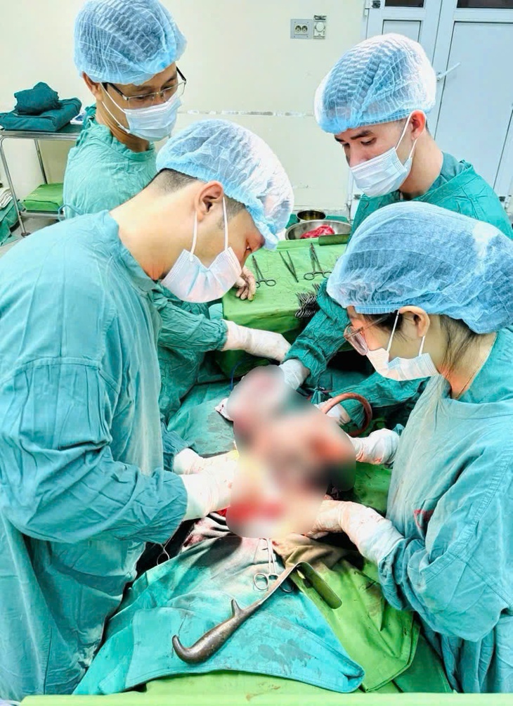 Bụng to bất thường, đi khám phát hiện khối u xơ tử cung khổng lồ- Ảnh 1.