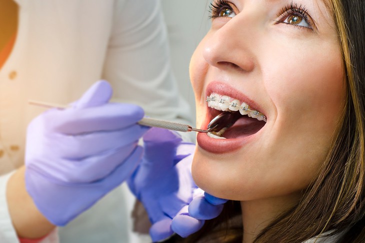 Nên ăn gì khi niềng răng để đảm bảo dinh dưỡng?- Ảnh 1.