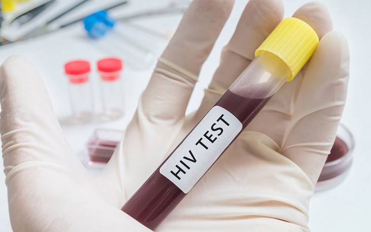 Xét nghiệm HIV - Bước quan trọng để phát hiện sớm và ngăn ngừa lây nhiễm